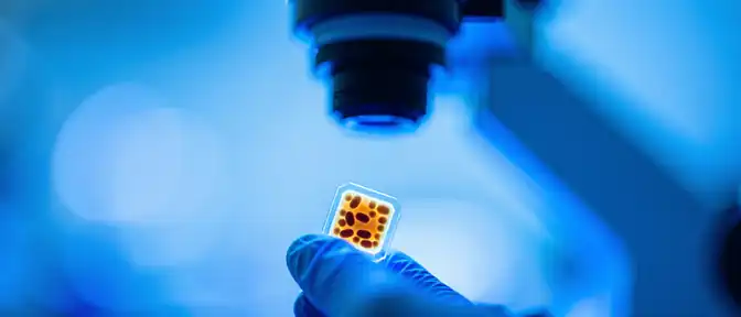 Инновационная методика Роспотребнадзора позволит оперативно определять резистентность бактерий к метициллину